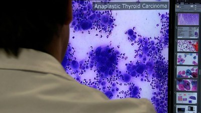 Ferran Marqués, professor de l'ETSETB, guardonat amb el 15è Premi UPC de Valorització de la Recerca